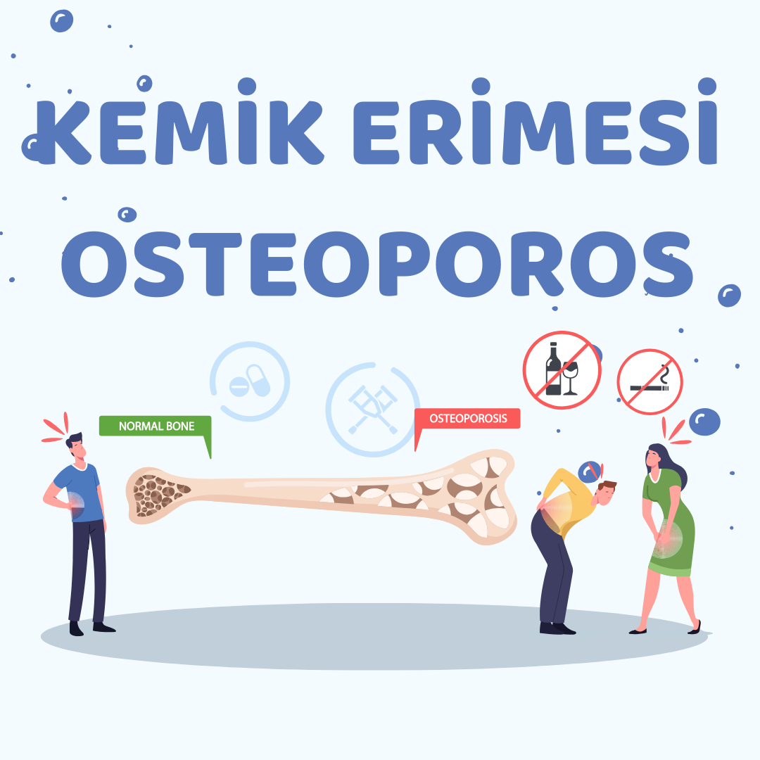 KEMİK ERİMESİ (OSTEOPOROS)